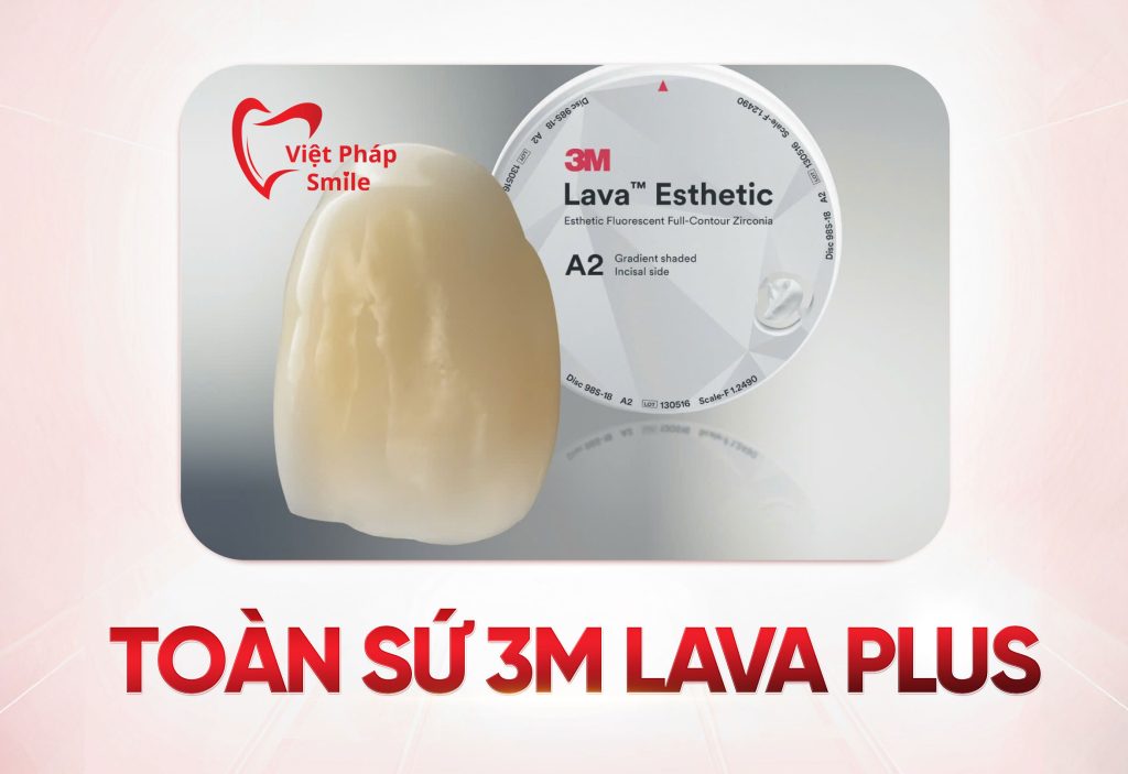 Răng toàn sứ 3M Lava Plus