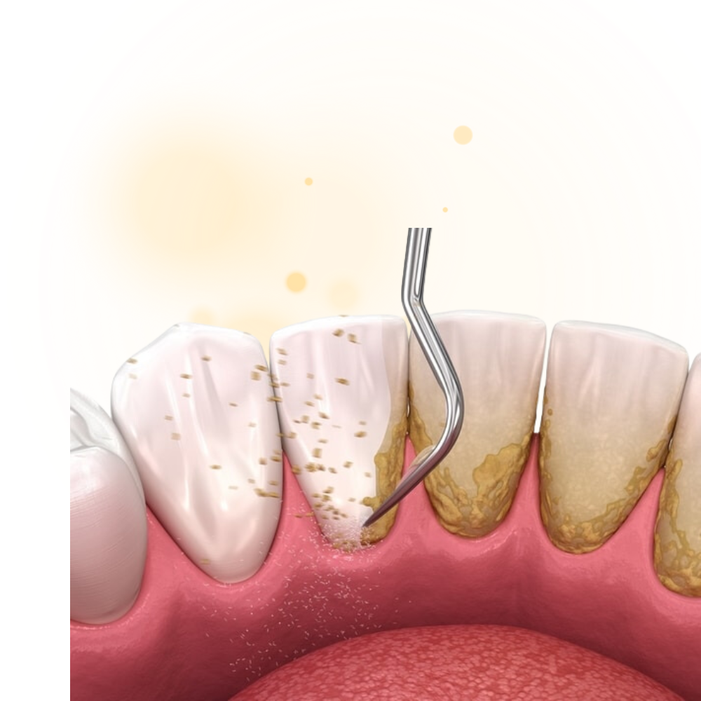 cao-voi-rang-nha-khoa-vie-phap-smile