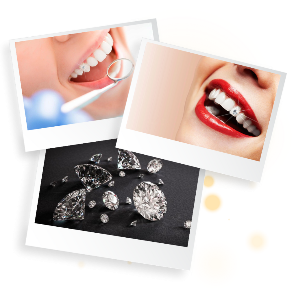 dinh da vao rang viet phap smile 11