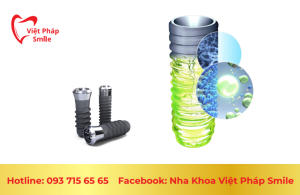 implant thụy sỹ