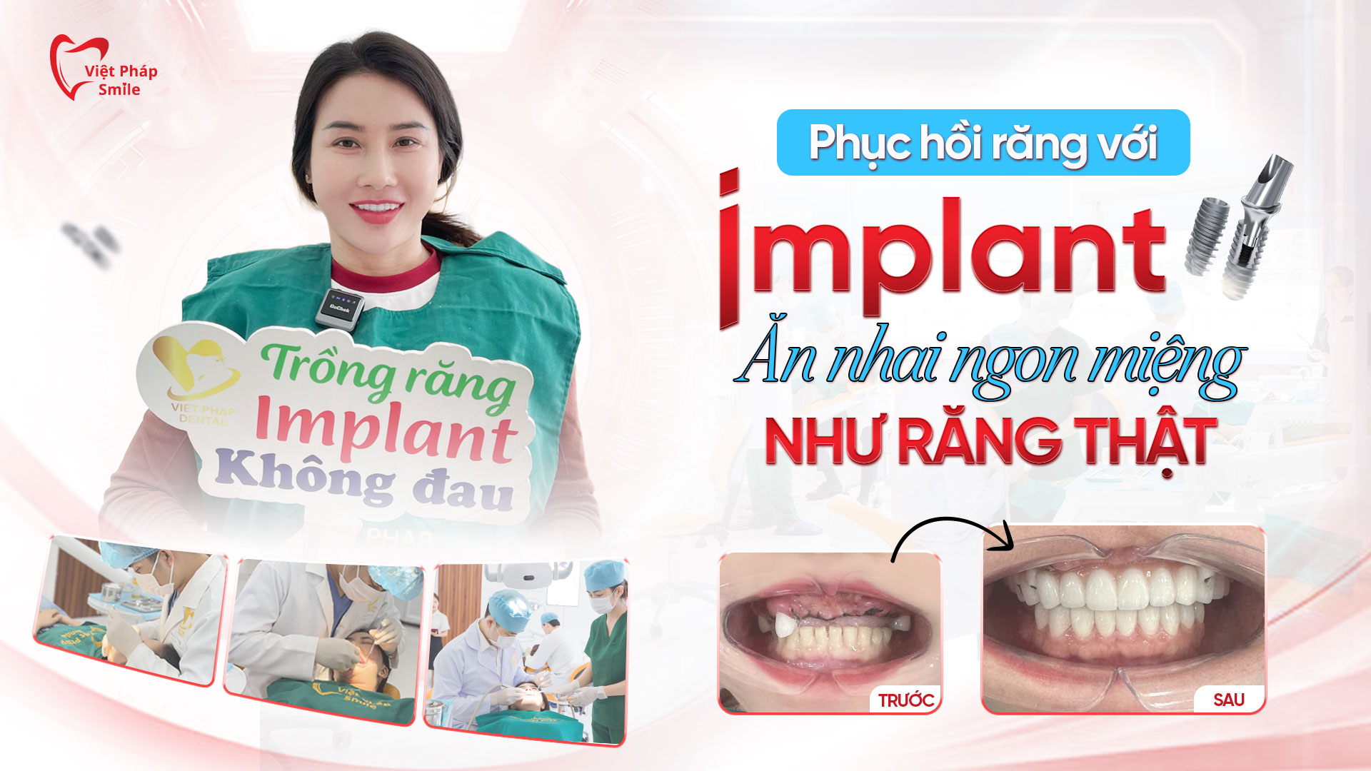 implant