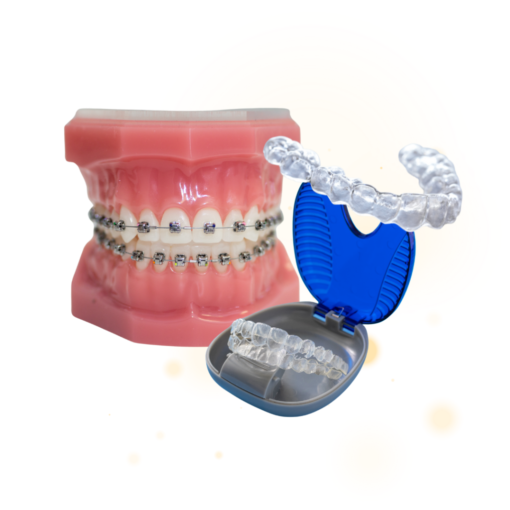 loi ich nieng rang tai viet phap smile 1