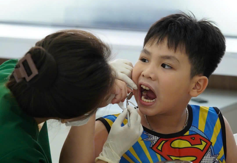 nho rang sua viet phap smile