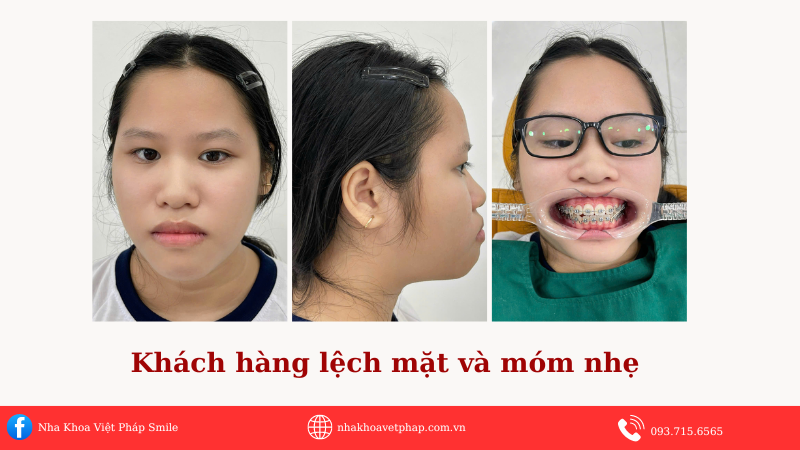 khach-hang-lech-mat-và-mom-nhe