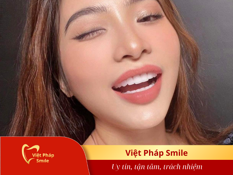 lam-rang-su-co-gay-dau-trong-qua-trinh-thuc-hien-khong