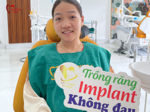 loi-ich-khi-trong-implant-tai-viet-phap-smile