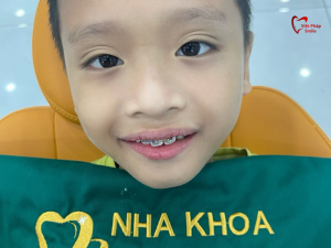 nieng-rang-do-tuoi-nao