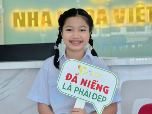 nieng-rang-kim-loai-nha-khoa-viet-phap-smile