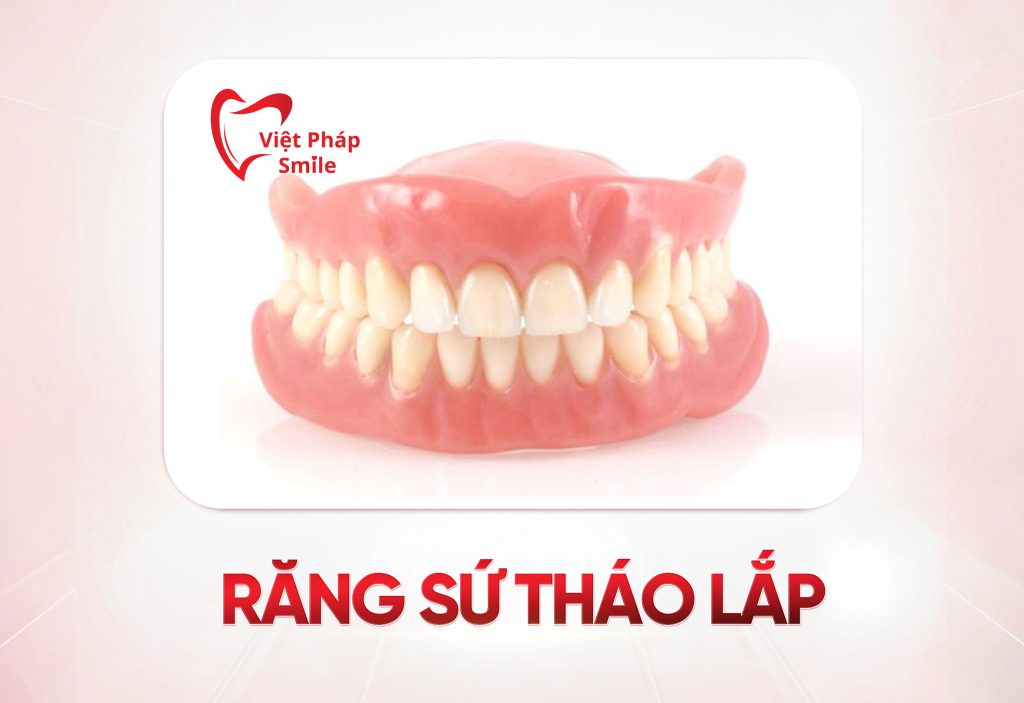 rang-su-thao-lap