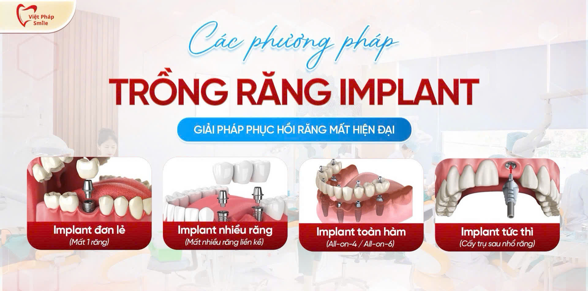 cac-phuong-phap-trong-rang-implant