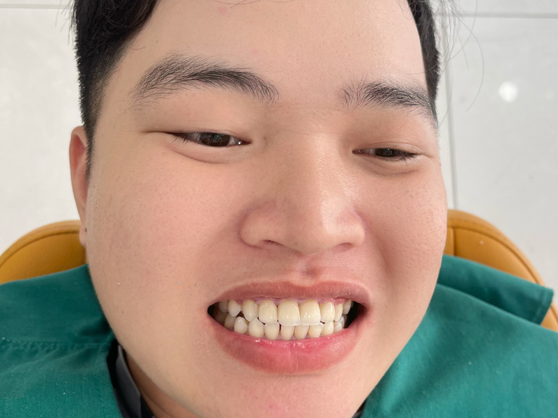 dan-su-rang-tai-long-an-uy-tin