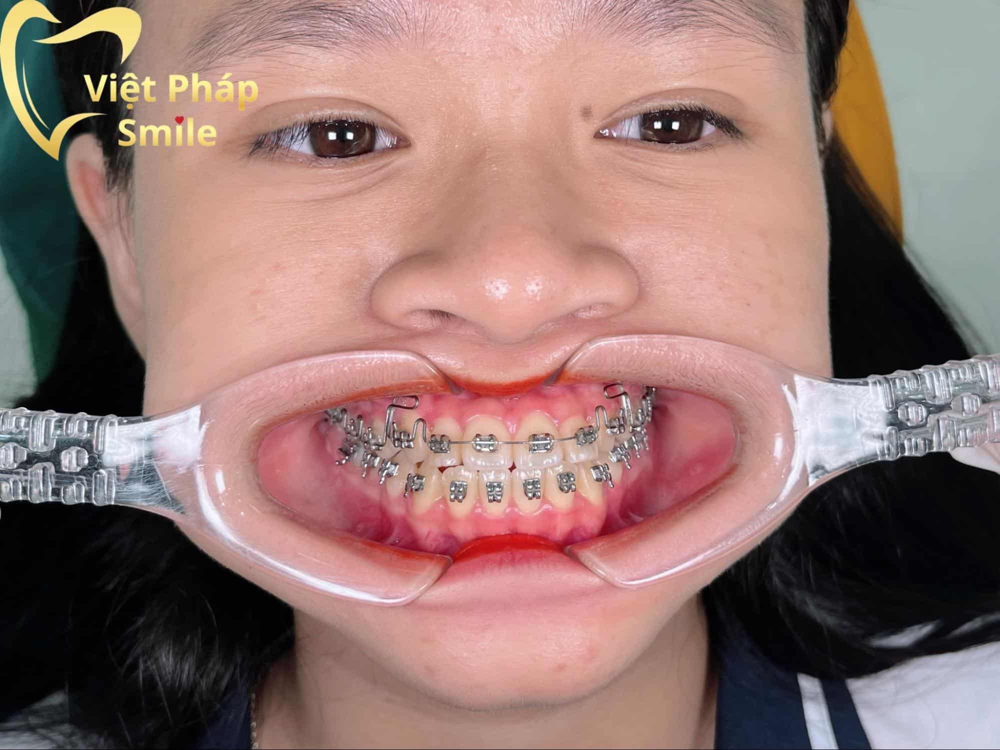 nhakhoavietphap