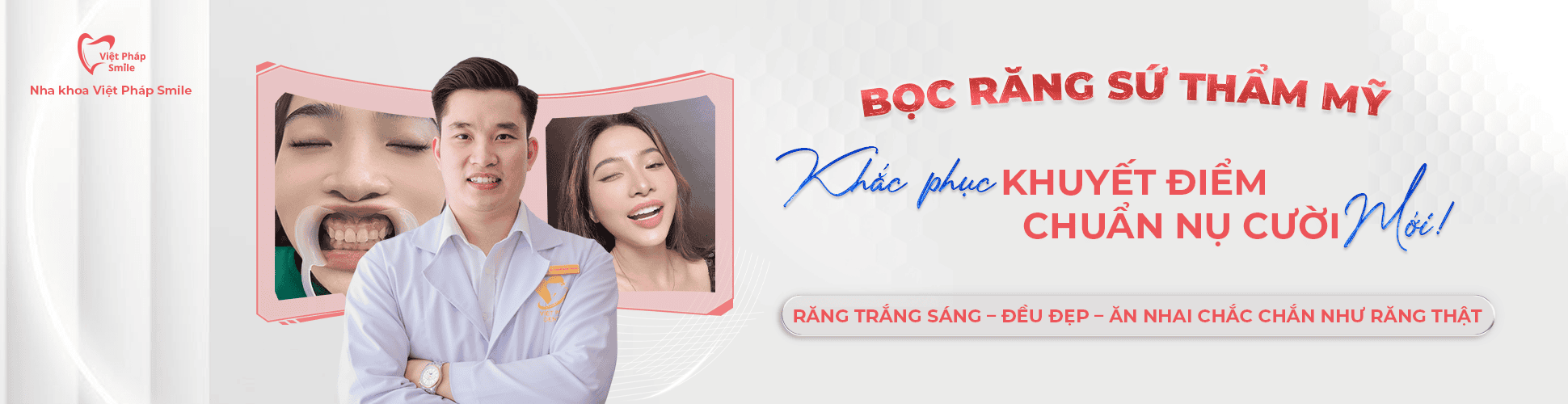 BỌC RĂNG SỨ THẨM MỸ