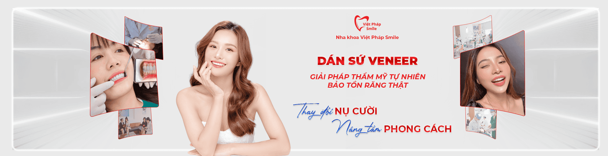 Dán sứ Veneer