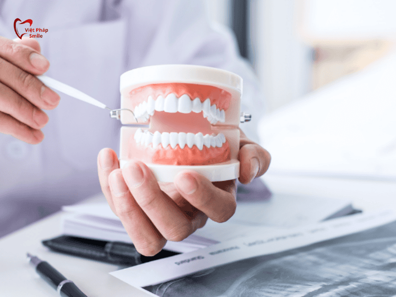 Ưu và nhược điểm của hàm tháo lắp so với cầu răng và implant