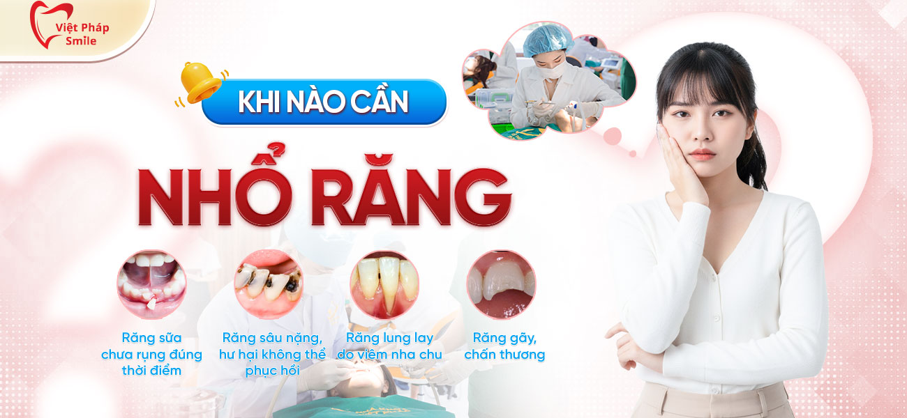 khi nao nen nho rang