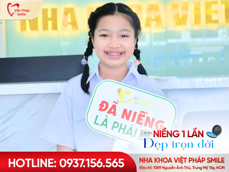 . Niềng răng – Chỉnh nha thẩm mỹ, nụ cười chuẩn khớp cắn