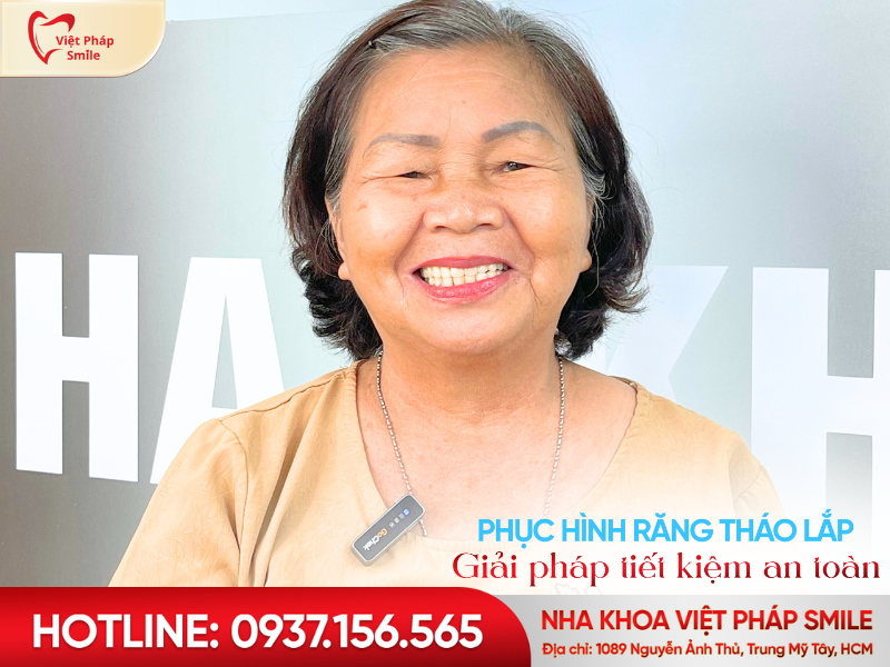 Phục hình răng tháo lắp – Giải pháp tiết kiệm, an toàn cho người mất răng