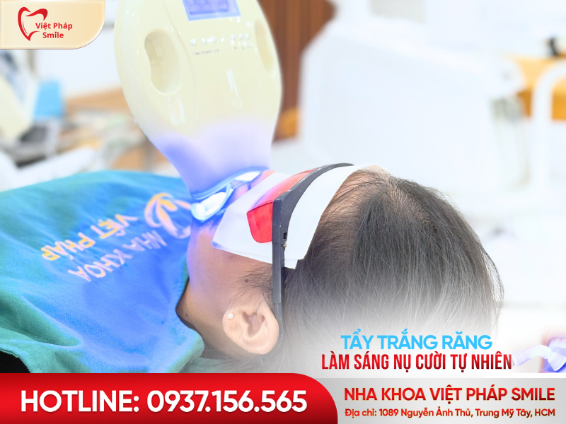 Tẩy trắng răng Laser