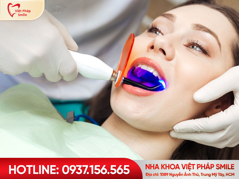 Tẩy trắng răng bằng công nghệ Plasma