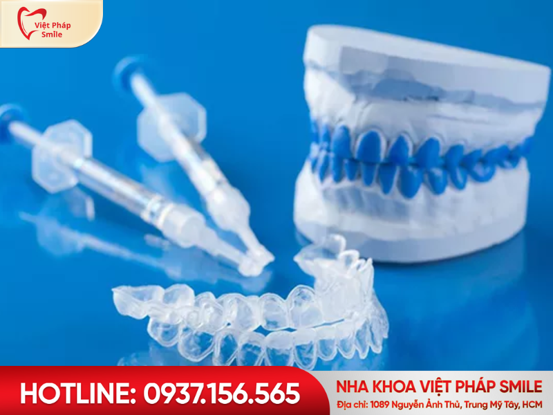 Tẩy trắng răng bằng máng tại nhà