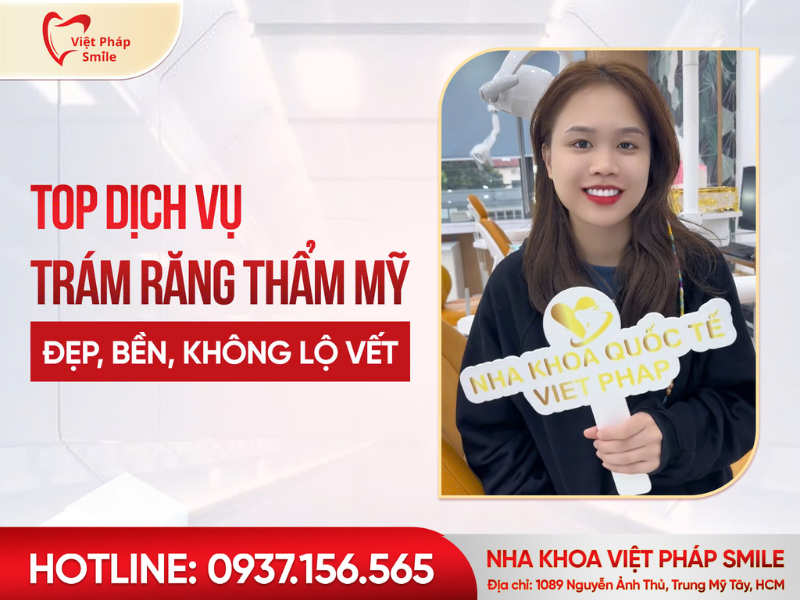 Top dịch vụ trám răng thẩm mỹ TP.HCM đẹp, bền, không lộ vết