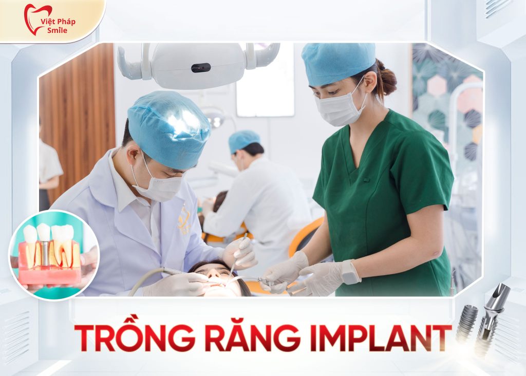 dich-vu-trong-implant-tai-nha-khoa-viet-phap-smile