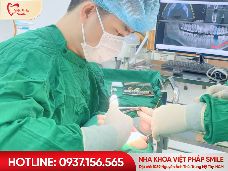 dich-vu-trong-implant