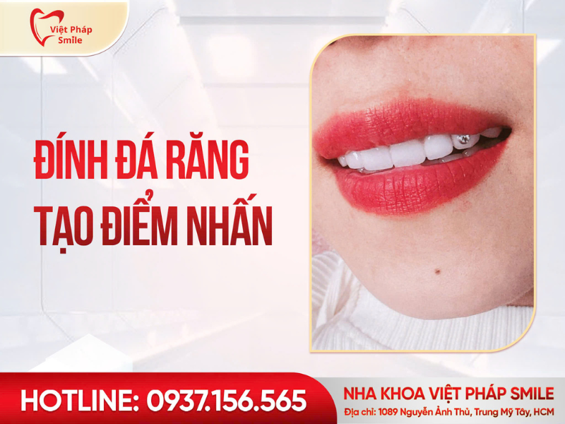 dinh-dA-rang