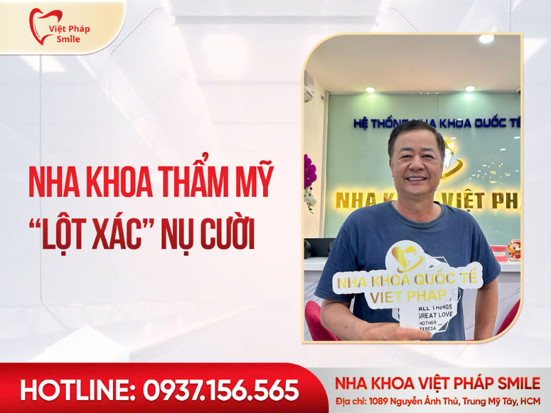 Top 5 nha khoa thẩm mỹ TP.HCM