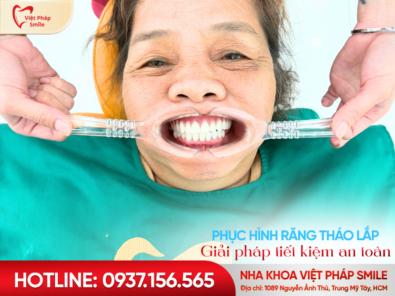 phục hình hàm giả