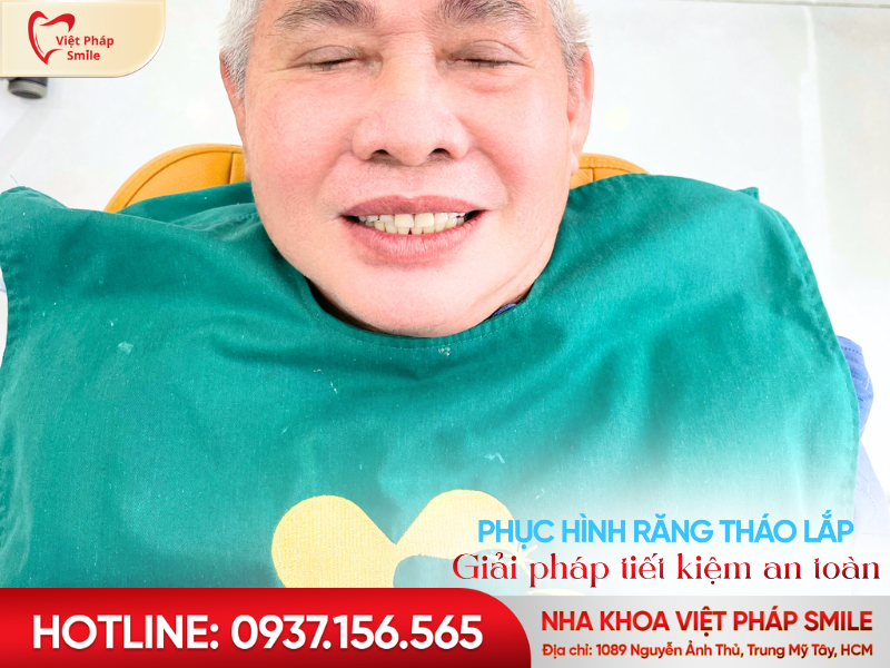 phuc hinh rang thao lap