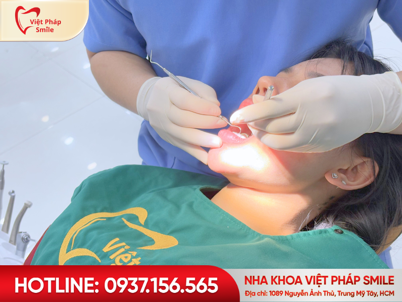 răng sứ cao cấp
