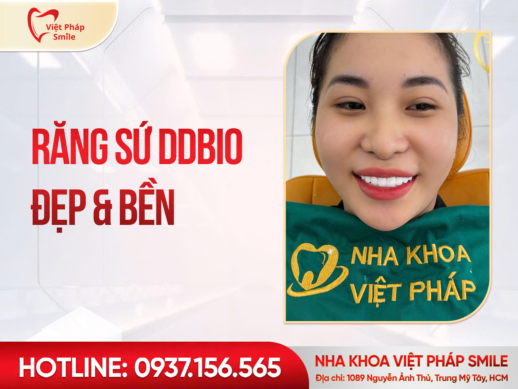 rang-su-ddbio-ben-dep