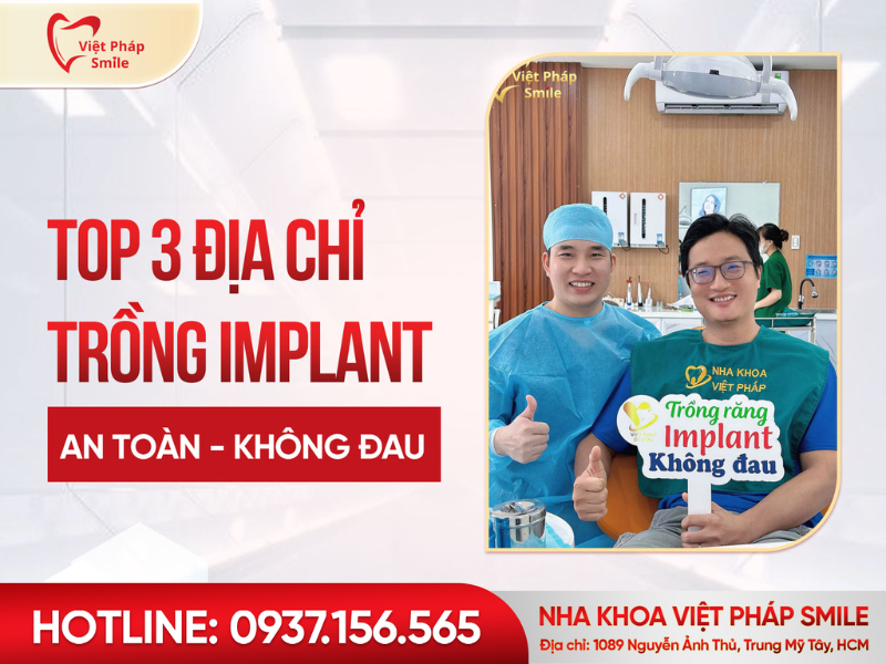 top-3-dia-chi-trong-implant