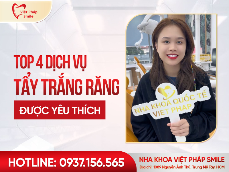top-4-dich-vu-tay-trang-rang-1