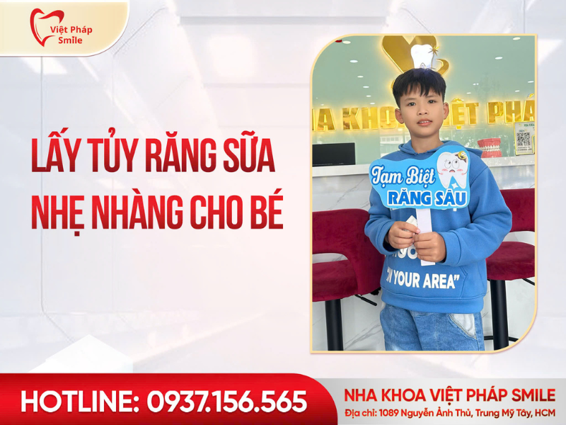 Lấy tủy răng sữa