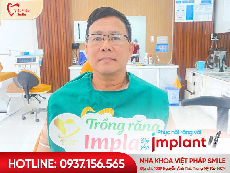 ai nen lam cau rang su 2