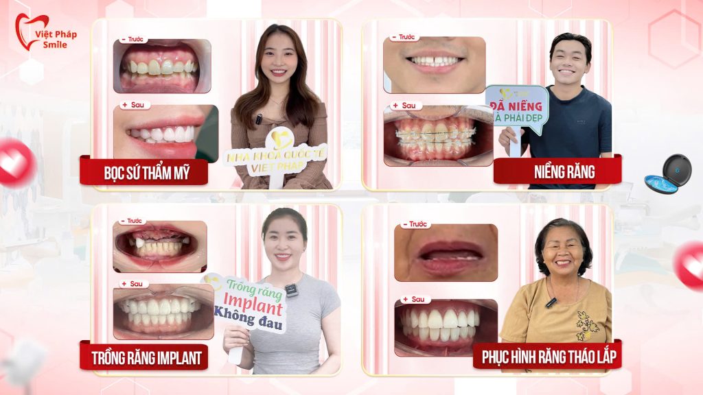 Nha sĩ giỏi là yếu tố quyết định kết quả điều trị răng miệng 4 dich-vu-noi-bat-cua-nha-khoa