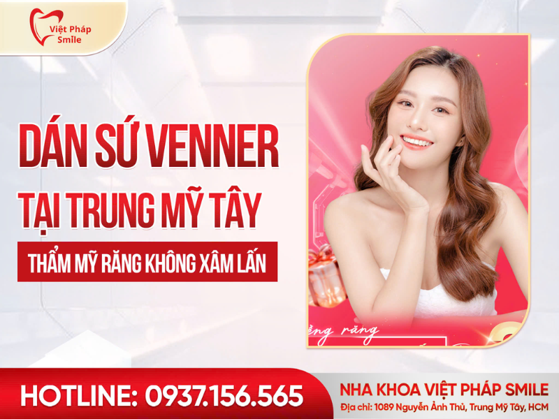Dán sứ Veneer Trung Mỹ Tây