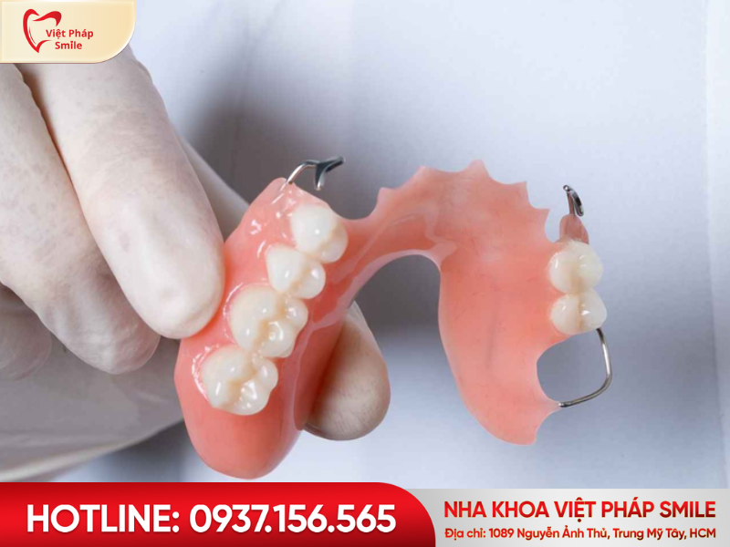 Hàm giả tháo lắp – Giải pháp tạm thời, nhẹ nhàng cho người cao tuổi