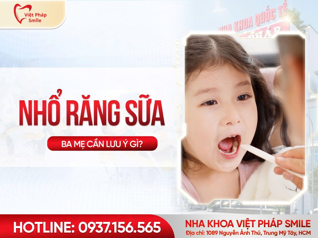 Khi nào nên nhổ răng sữa cho bé và những lưu ý cha mẹ cần biết