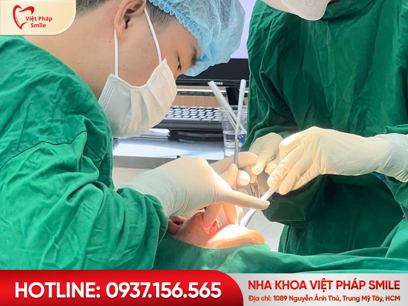 Lý do nên chọn Nha khoa Việt Pháp Smile Trung Mỹ Tây để trồng răng Implant