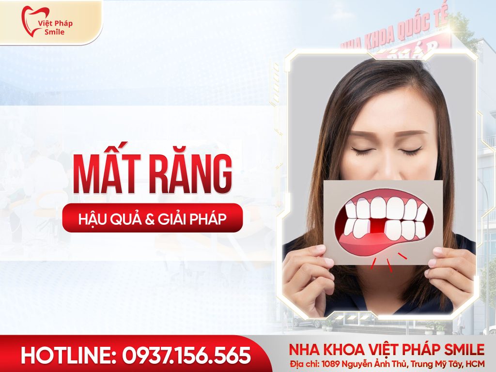 Mất răng lâu năm có sao không Giải pháp phục hồi răng hiệu quả