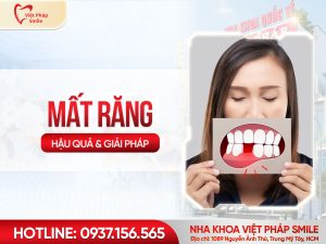 Mất răng lâu năm có sao không Giải pháp phục hồi răng hiệu quả