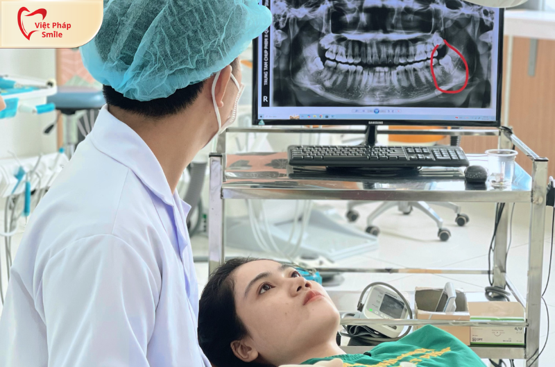 Nha sĩ giỏi là yếu tố quyết định kết quả điều trị răng miệng 2 Quy trình nhổ răng khôn an toàn tại Nha khoa Việt Pháp Smile