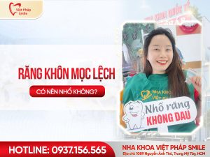 Răng khôn mọc lệch Khi nào cần nhổ và lưu ý sau khi nhổ