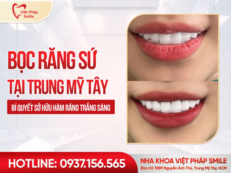 boc-rang-su-tai-trung-my-tay