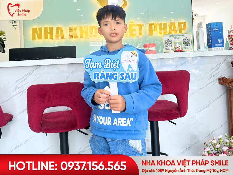 Sâu răng là gì? Nguyên nhân, dấu hiệu và cách điều trị hiệu quả 3 nho-rang-tai-nha-khoa-viet-phap-smile