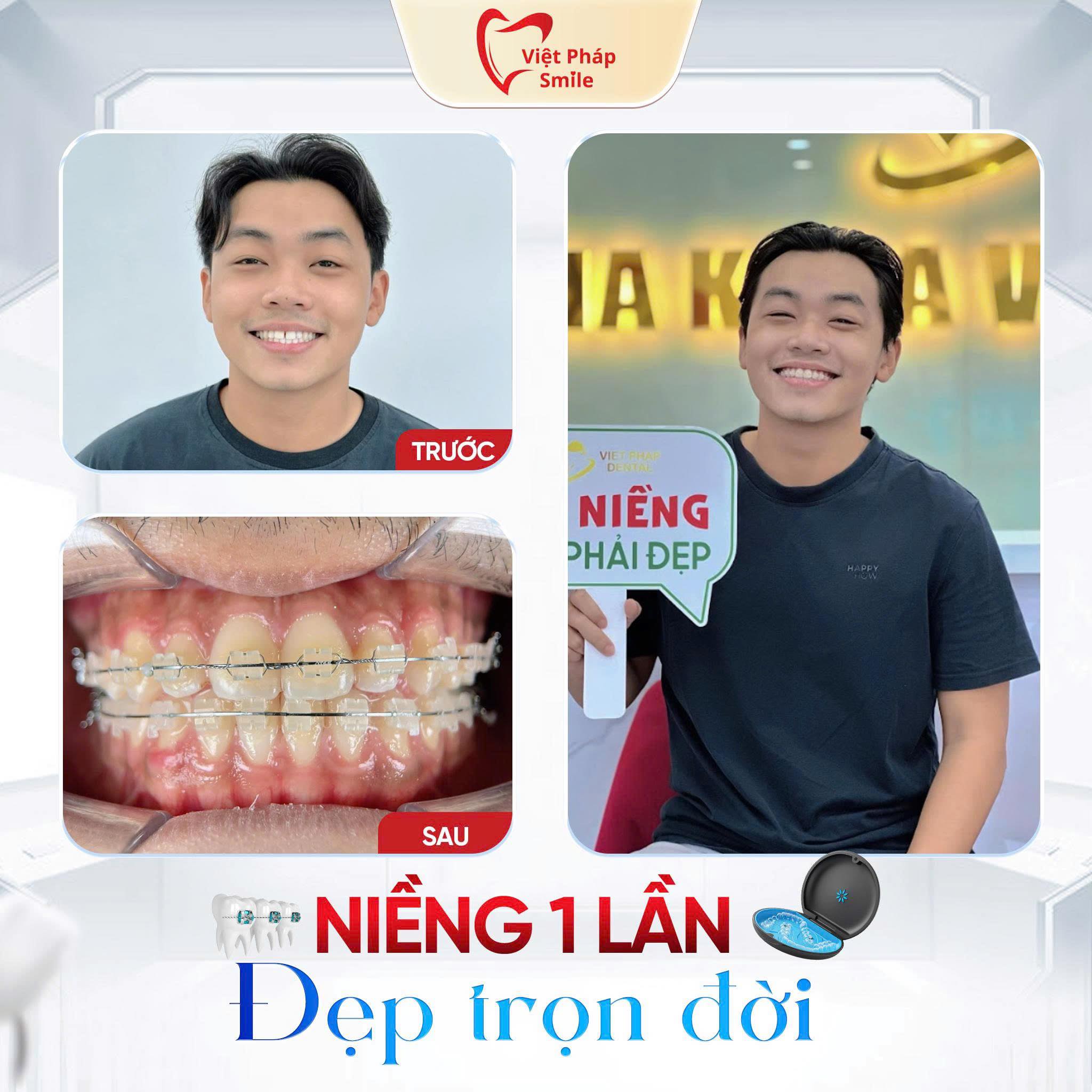 khach-hang-nieng-rang-1